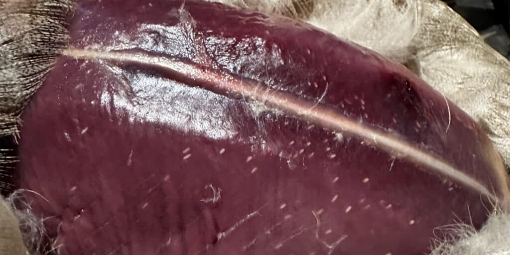 An example of a breast with rice breast disease